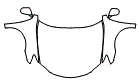 2008 Lexus ES 350 Hood, Fender and Mirror Kit - PPF