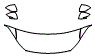 2017 Hyundai Elantra Hood, Fender and Mirror Kit - PPF