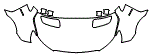 2024 Mercedes Benz Sprinter Full Hood and Fender Kit - PPF