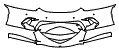 2025 McLaren GTS Bumper Kit - PPF